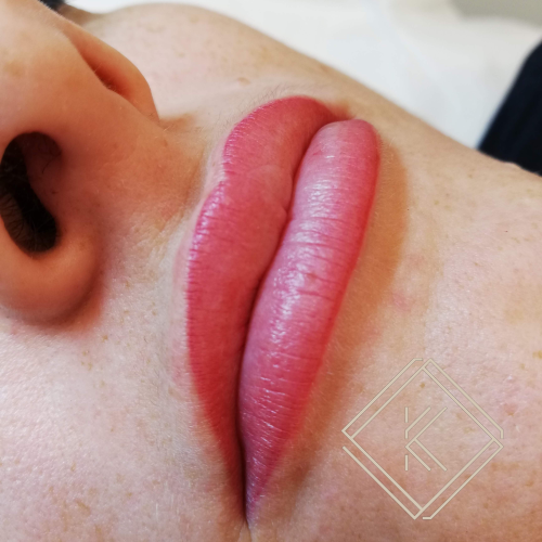 b (10) — kopia