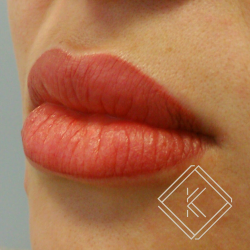 b (5) — kopia